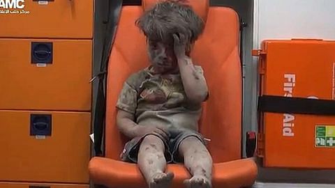 Budak berlumuran darah mangsa perang di Syria dapat simpati ramai