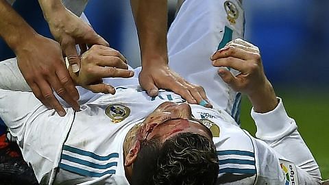 Ronaldo berdarah walau Real menang besar 7-1