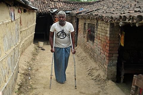 KESAN BERLARUTAN ARSENIK: Kaki kiri bekas petani, Encik Ramprasad Yadap, terpaksa dipotong selepas bertahun-tahun keracunan arsenik daripada air yang beliau minum di daerah Nawalparasi di wilayah Terai selatan Nepal, kawasan tanah rendah.