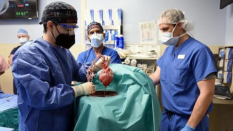 Pemindahan pertama jantung babi ke manusia