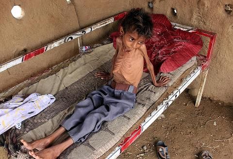 MANGSA PERANG: Seorang kanak-kanak Yaman menghadapi kebuluran serius ekoran kesukaran mendapatkan makanan yang mencukupi.- Foto AFP ENCIK HANS GRUNDBERG: Foto EPA-EFE KASIHANI NASIB ANAK: Encik Ali Jabri (kiri) sedih melihat anaknya Ayoub yang kini d
