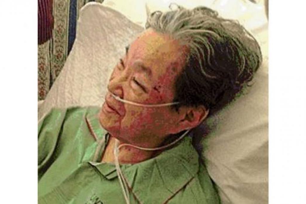 MANGSA SAMUN: Cik Juliana Lim Nyo Nya meninggal dunia ketika mendapatkan rawatan di Hospital Tuanku Ja'afar Seremban. - Foto fail