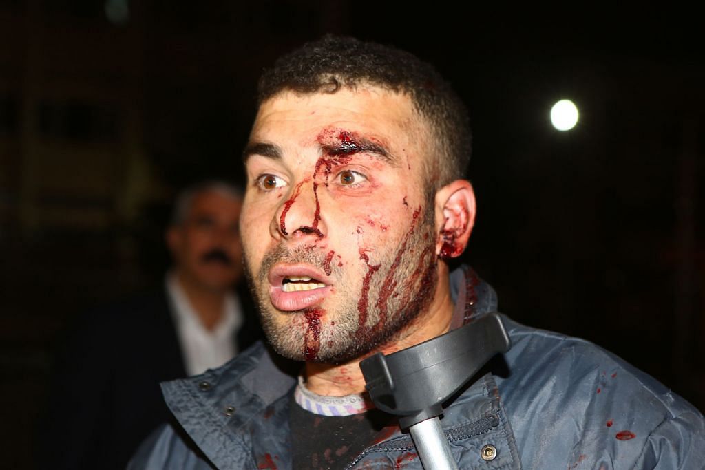 TRAGEDI SERANGAN PENGGANAS DI TURKEY 'Angkara' berdarah pengebom nekad