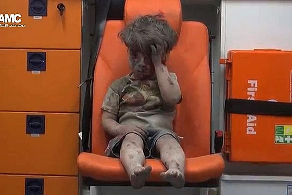 Budak berlumuran darah mangsa perang di Syria dapat simpati ramai