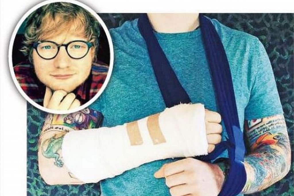 Ed Sheeran batal persembahan lepas terlibat dalam nahas basikal
