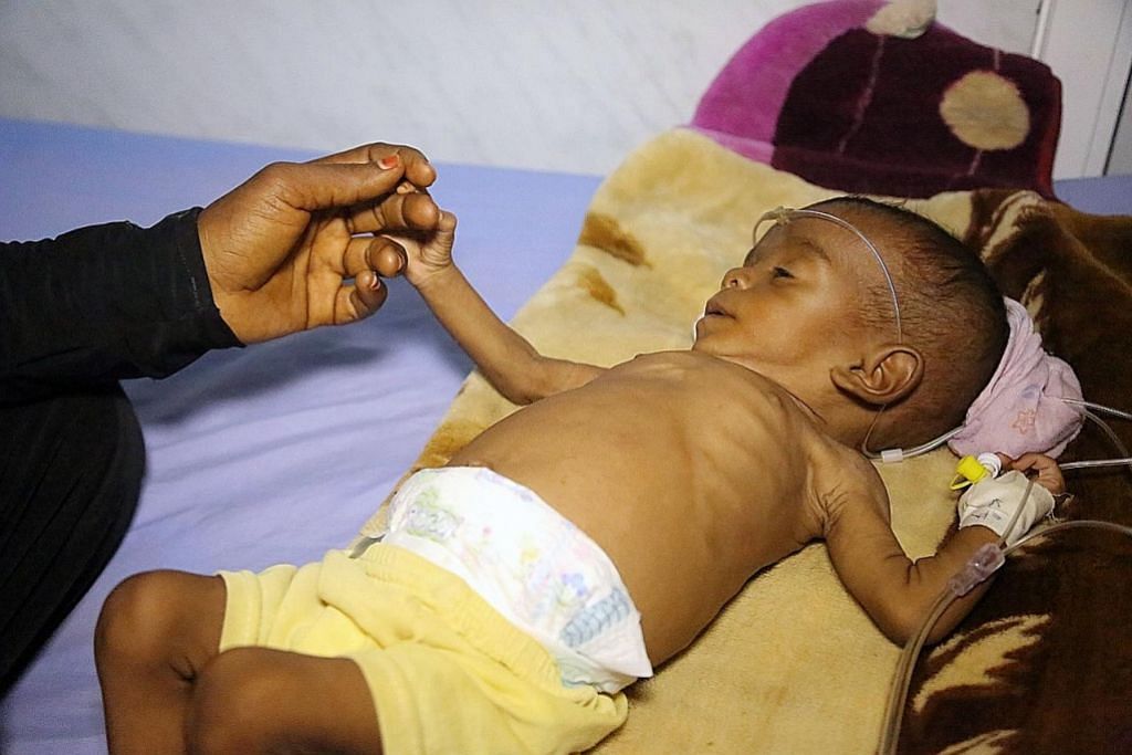 Jutaan kanak-kanak Yaman menderita lapar, penyakit