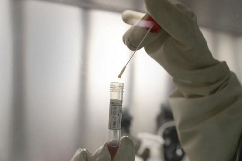 Singapore sends coronavirus test kits to Brunei