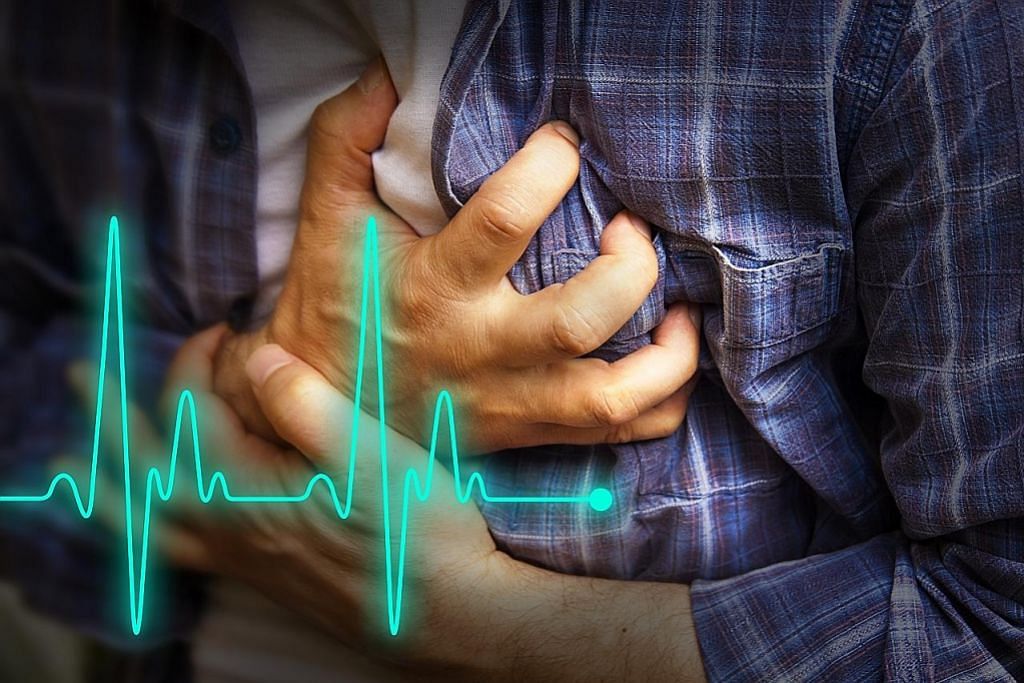 Adakah serangan jantung selalu disertai dengan sakit dada?